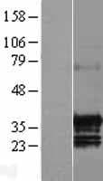 GID4 Protein (Over-Expression Lysate Myc-DDK (Flag))
