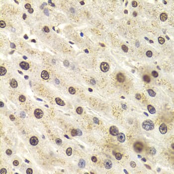 Polyclonal Rabbit anti-Human HNRNPD / AUF1 Antibody (IHC, WB)