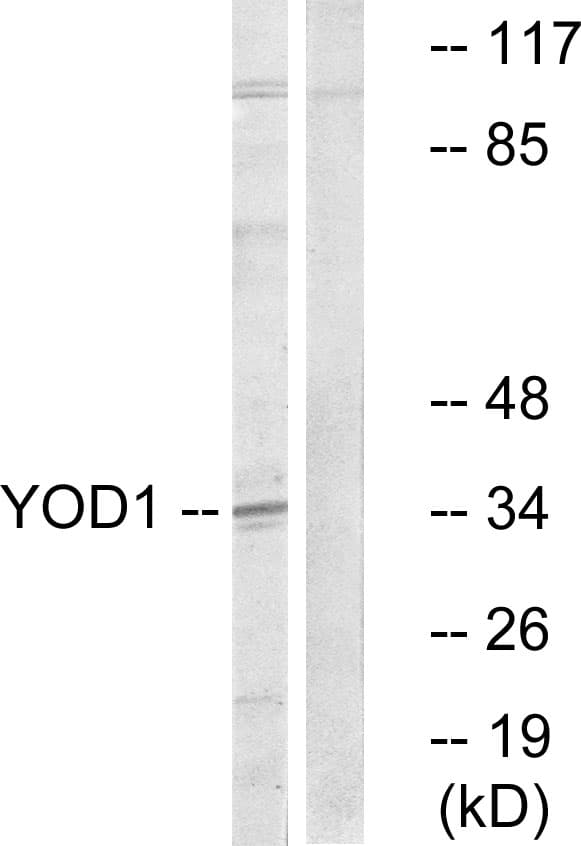 YOD1 Antibody (aa116-165)