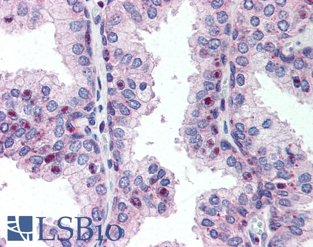 IHC-plus™ CENPU / MLF1IP Antibody
