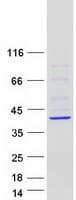 Human HYLS1 Protein (Recombinant Myc-DDK (Flag))