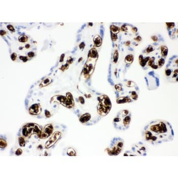 SLC4A1 / Band 3 / AE1 Antibody (aa28-365)