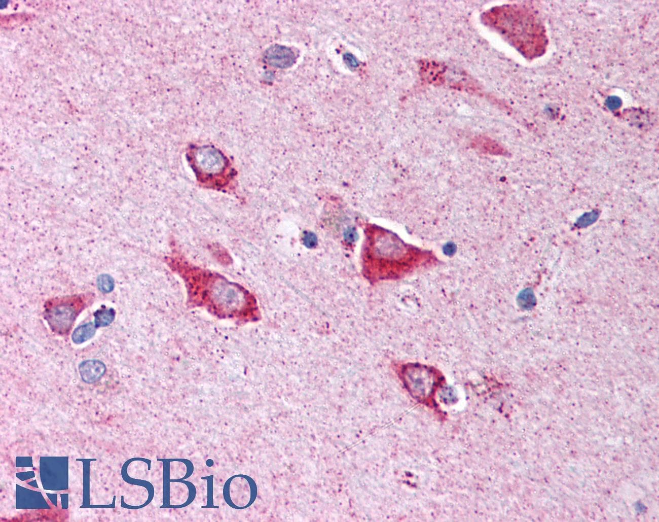 PathPlus™ HSPA9 / Mortalin / GRP75 Antibody (N-Terminus)