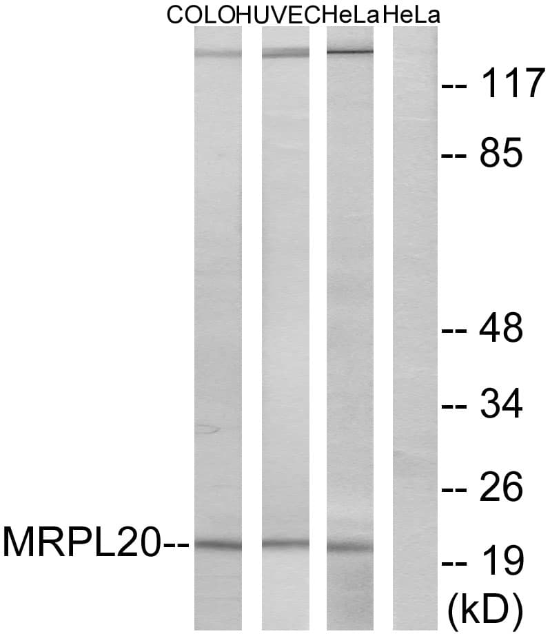 IHC-plus™ MRPL20 Antibody (aa100-149)