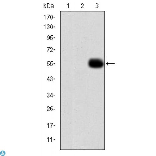 MMP9 / Gelatinase B Antibody