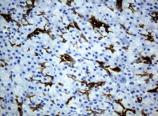 KRT19 / CK19 / Cytokeratin 19 Antibody (aa240-390, clone UMAB3, Carrier-free)