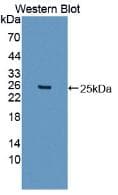 ITIH5 Antibody (aa569-737, PE)