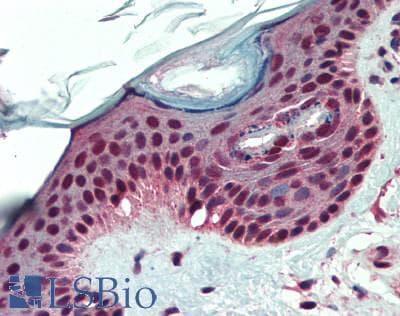 IHC-plus™ SKI Antibody (aa450-500)