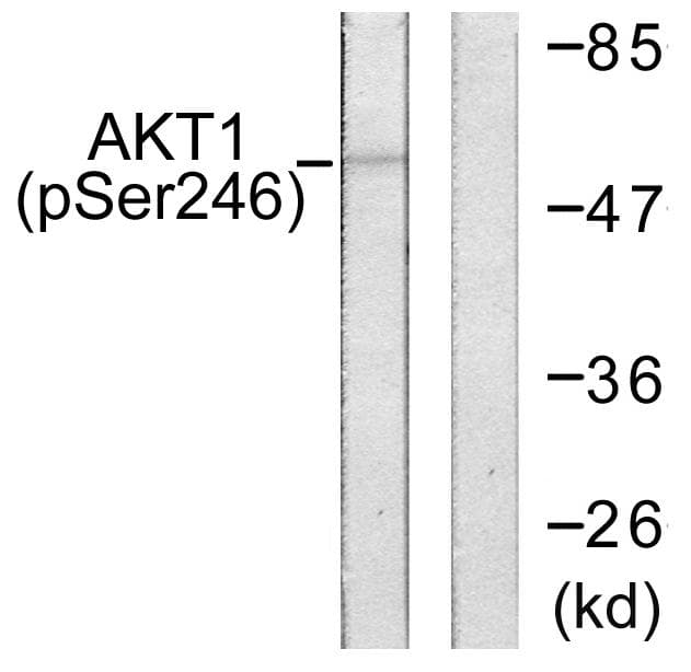 Polyclonal Rabbit anti-Human AKT1 Antibody (phospho-Ser246, IHC, IF, WB)