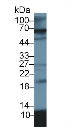 S100A12 Antibody (aa2-92)