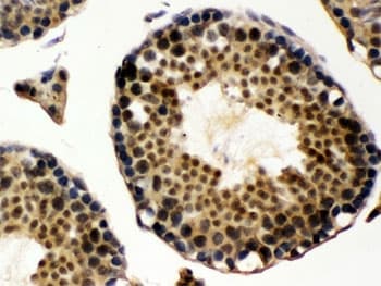 UBA3 / UBE1C Antibody