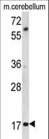 Polyclonal Rabbit anti-Human MOBP Antibody (aa1-30, IHC, WB)