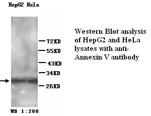 IHC-plus™ ANXA5 / Annexin V Antibody