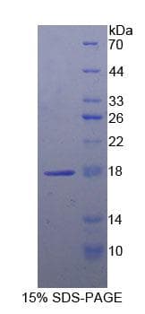 Human LCAT Protein (Recombinant His)