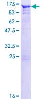 Human AMOT / Angiomotin Protein (Recombinant GST)
