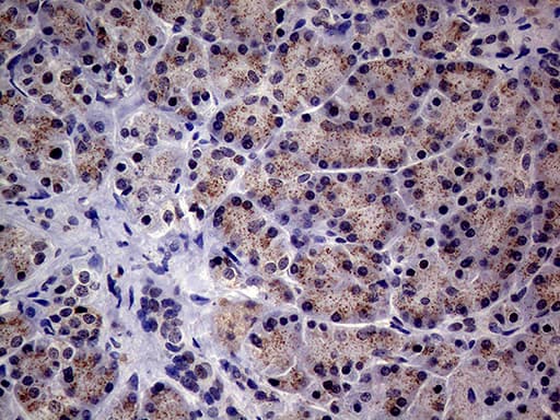 ALDP / ABCD1 Antibody (aa508-745, clone OTI3A1)