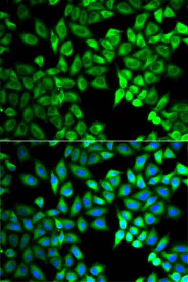 C10orf2 / PEO1 Antibody