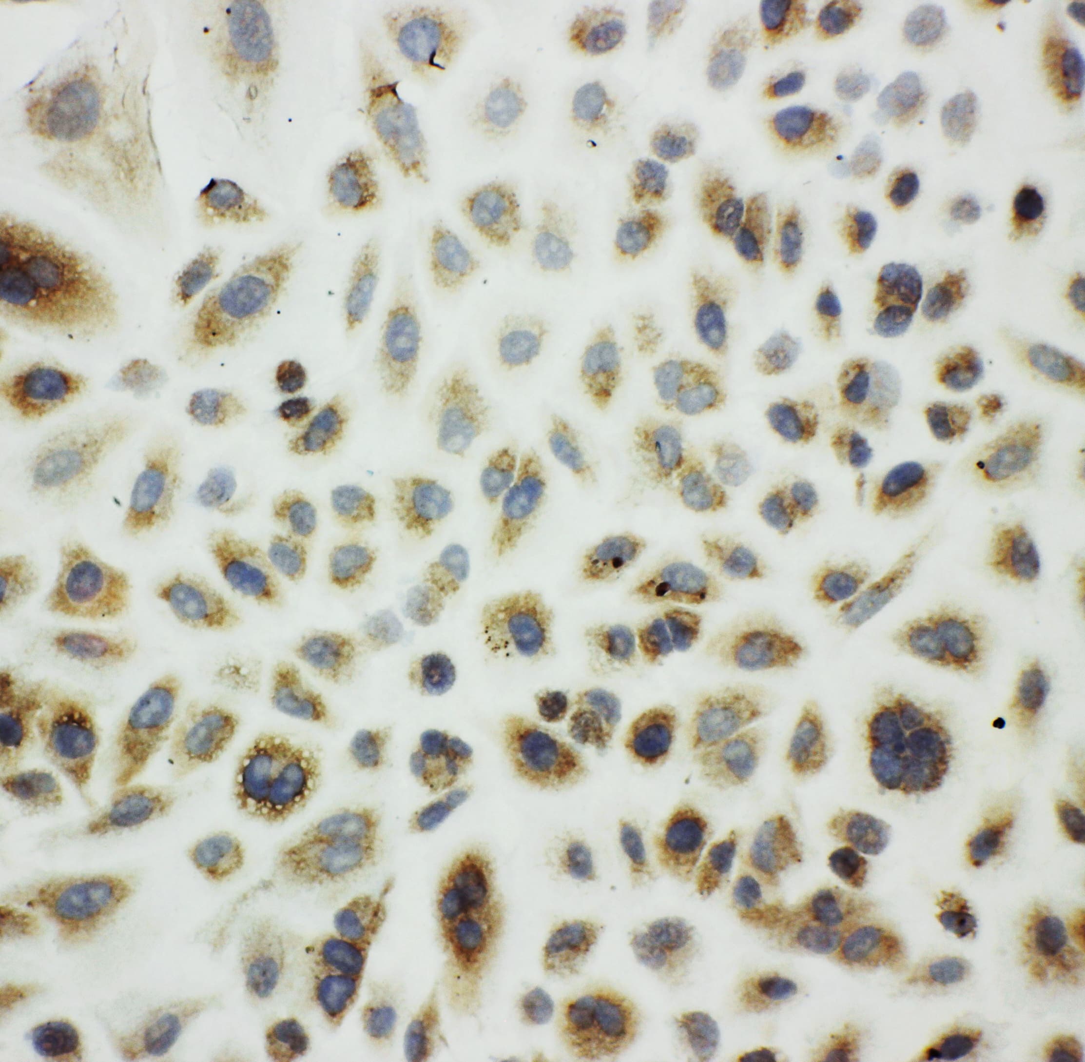 HSPE1 / HSP10 / Chaperonin 10 Antibody (aa81-102)