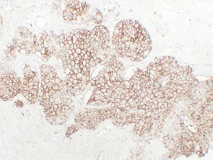 CDH16 / Cadherin 16 Antibody (clone ABT-CDH16)