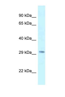 Polyclonal Rabbit anti-Mouse SUV420H1 Antibody (C-Terminus, IHC, WB)