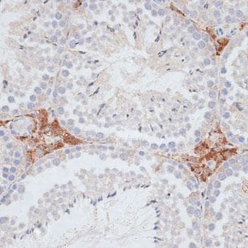 HSET / KIFC1 Antibody