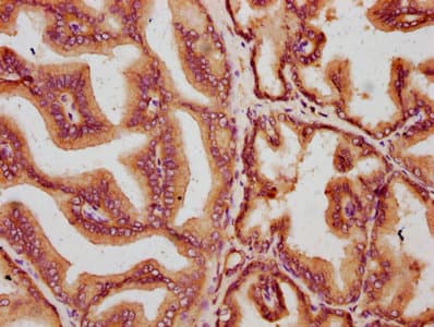 MKLN1 / Muskelin Antibody