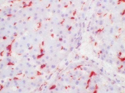 CD163 Antibody