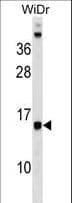 DAD1 Antibody (aa64-92)