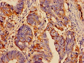 Polyclonal Rabbit anti-Human SST / Somatostatin Antibody