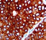 EPCAM Antibody (clone EP11)