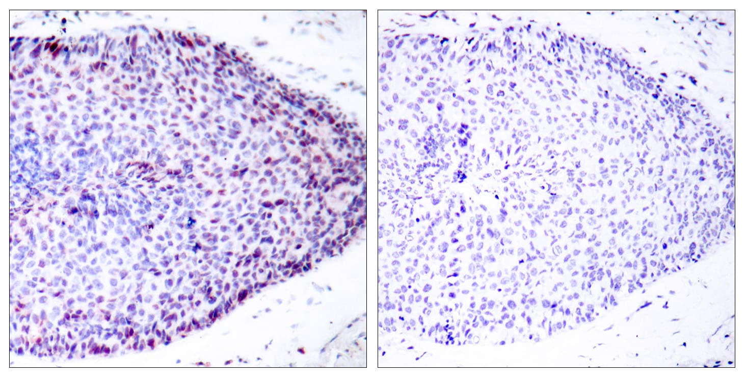 ATF2 Antibody (aa29-78)