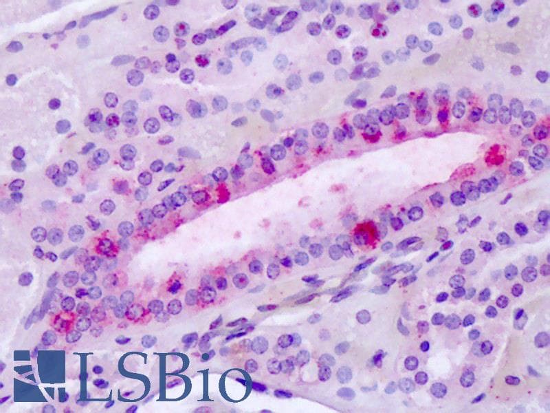 IHC-plus™ ADGRL3 / LPHN3 Antibody (C-Terminus)