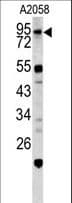 CALD1 / Caldesmon Antibody (aa428-457)