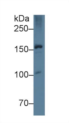 APOB / Apolipoprotein B Antibody (aa3365-3550, APC)