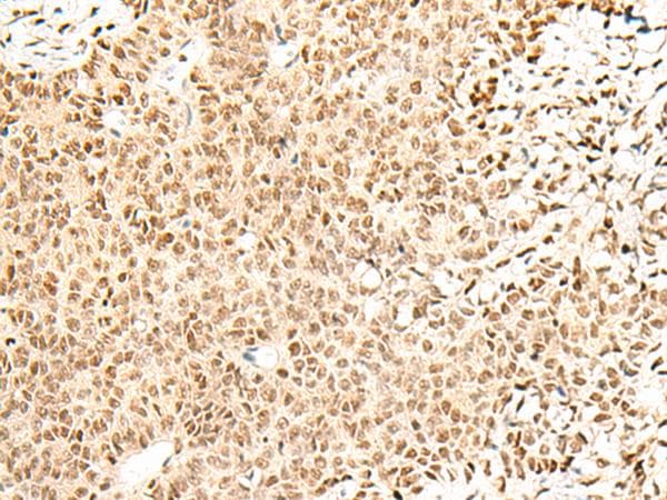 FKBP5 / FKBP51 Antibody