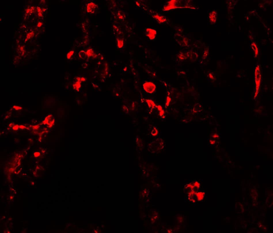 IHC-plus™ Polyclonal Rabbit anti-Human SUZ12 Antibody (IHC, IF, WB)