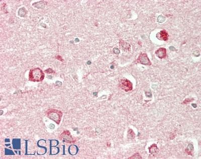 IHC-plus™ Polyclonal Rabbit anti-Human CLC-7 / CLCN7 Antibody (aa23-72, IHC, WB)