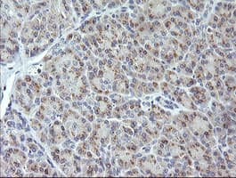 MAP2K3 / MEK3 / MKK3 Antibody (clone OTI4G4)