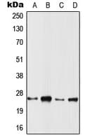 Polyclonal Rabbit anti-Human TC21 / RRAS2 Antibody (Internal, WB)