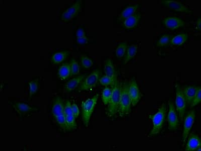 Polyclonal Rabbit anti-Human GLIPR1 / GLIPR Antibody (WB)