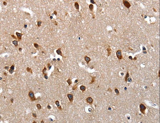 LAMA1 / Laminin Alpha 1 Antibody