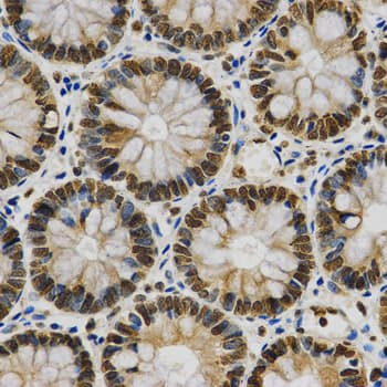 HNRNPA2B1 Antibody