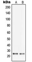 Polyclonal Rabbit anti-Human PGRMC2 Antibody (C-Terminus, WB)