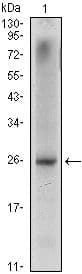 NKX3-1 Antibody (clone 4H4)
