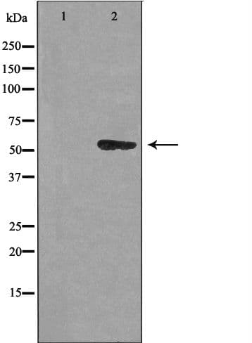 Polyclonal Rabbit anti-Human CEP55 Antibody (IHC, WB)