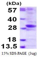 Human PHOSPHO2 Protein (Recombinant His)