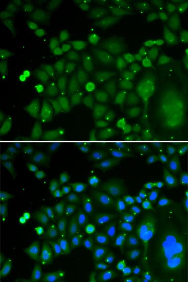 TDP-43 / TARDBP Antibody