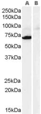 IHC-plus™ Polyclonal Goat anti-Human MAOA / Monoamine Oxidase Antibody (aa141-154, IHC, WB)