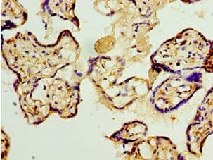 Polyclonal Rabbit anti-Human TET2 Antibody (aa1833-2002, IHC)