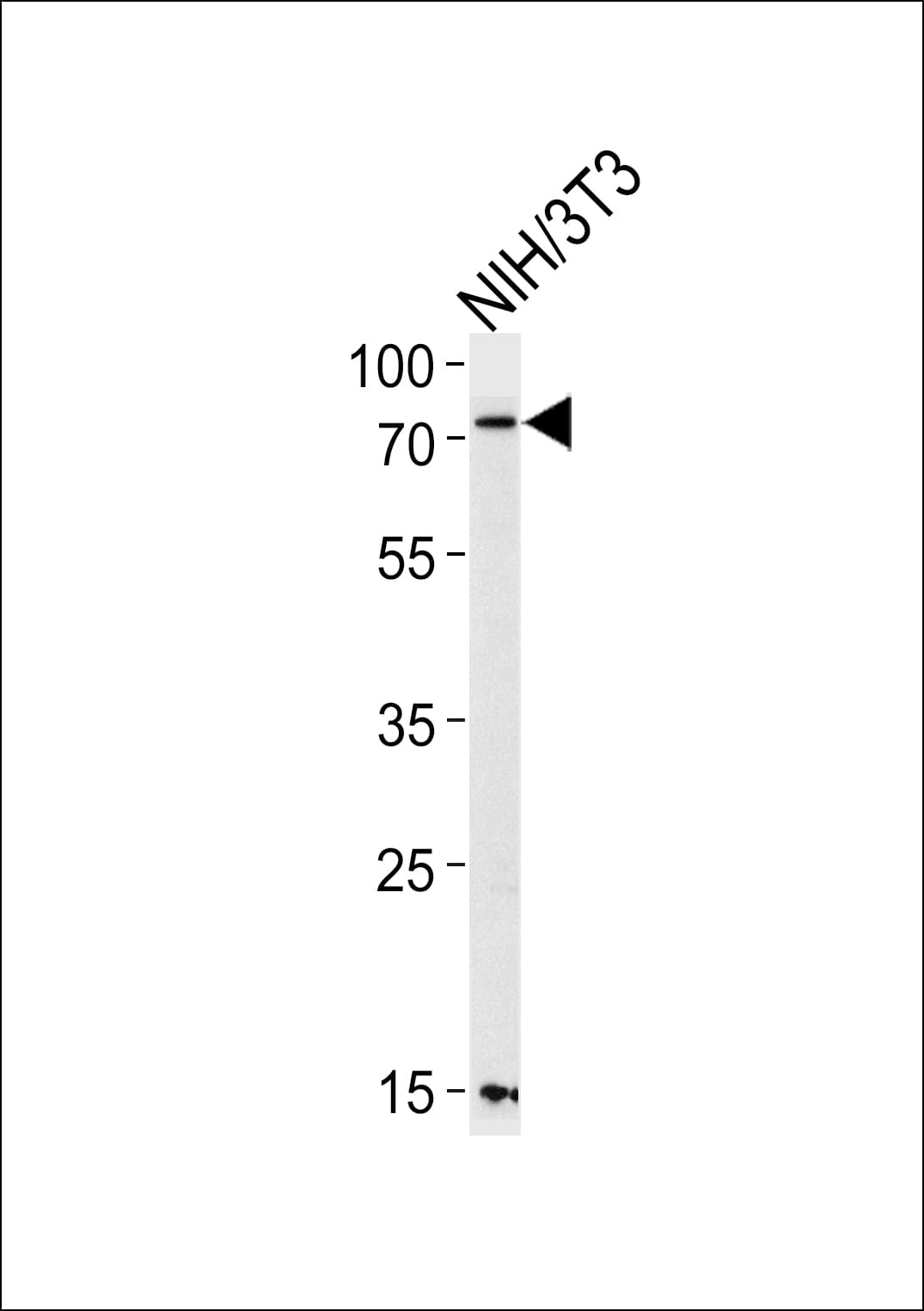 PAK3 Antibody (aa124-152)